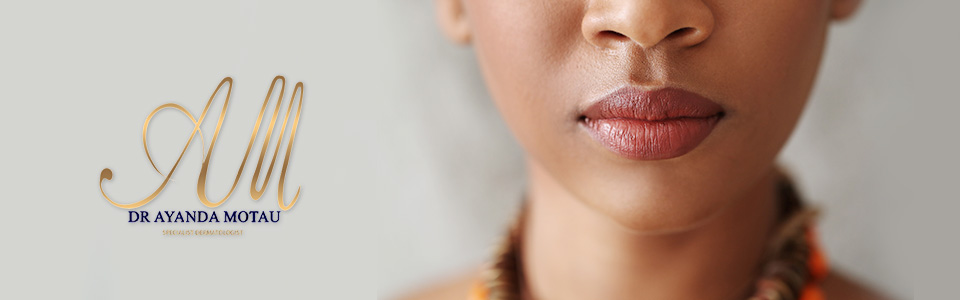 DrAyandaMotau Randburg Dermatologist